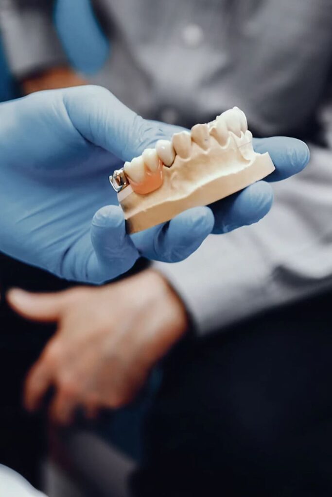 mano guante azul sujetando protesis