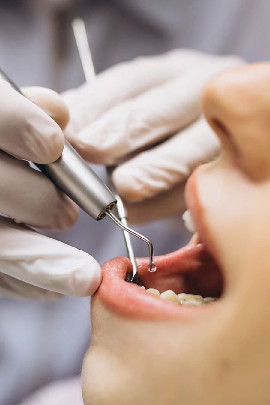 cirugia oral dentista