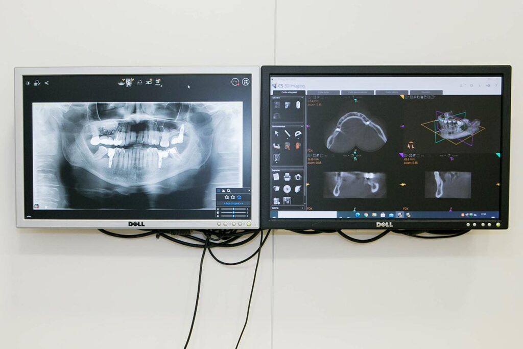 radiografia de la boca de un paciente