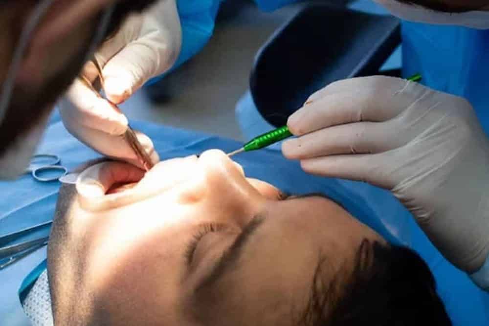 cirujanos dentales interviniendo a paciente