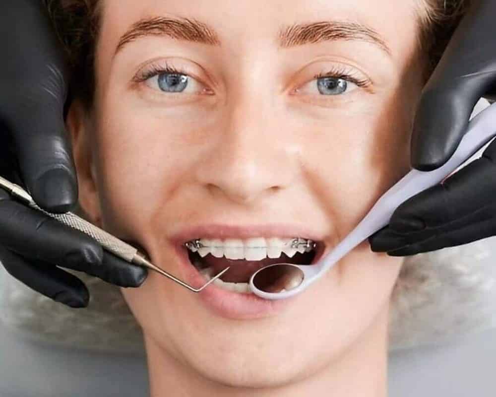 chica en el dentista con sus aparatos dentales metálicos