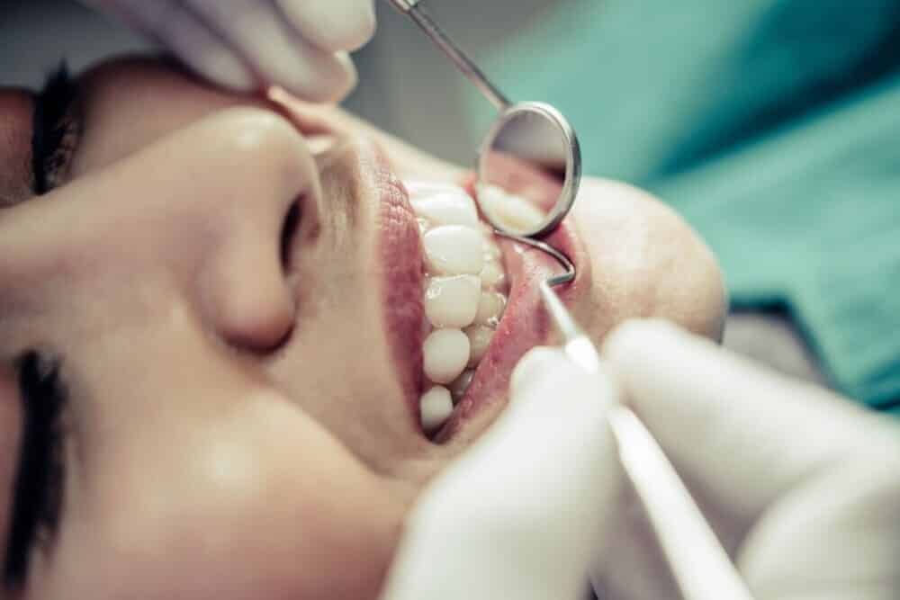dentista con artilugios dentales comprobando dientes paciente