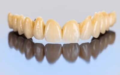 Precios de las prótesis dentales fijas en Zaragoza