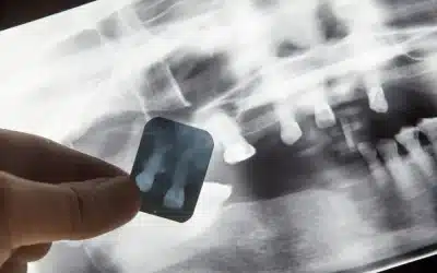Radiografía digital: ¿Qué es?
