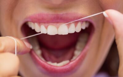 Diagnóstico de periodoncia