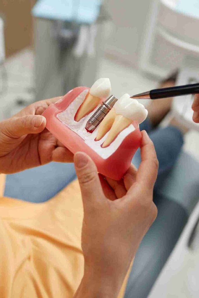 persona sujetando maqueta de implante dental