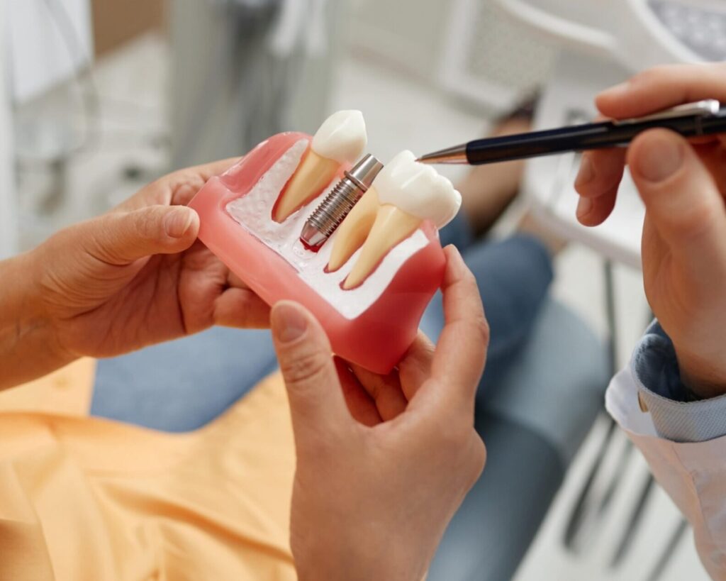 paciente con maqueta de impante dental