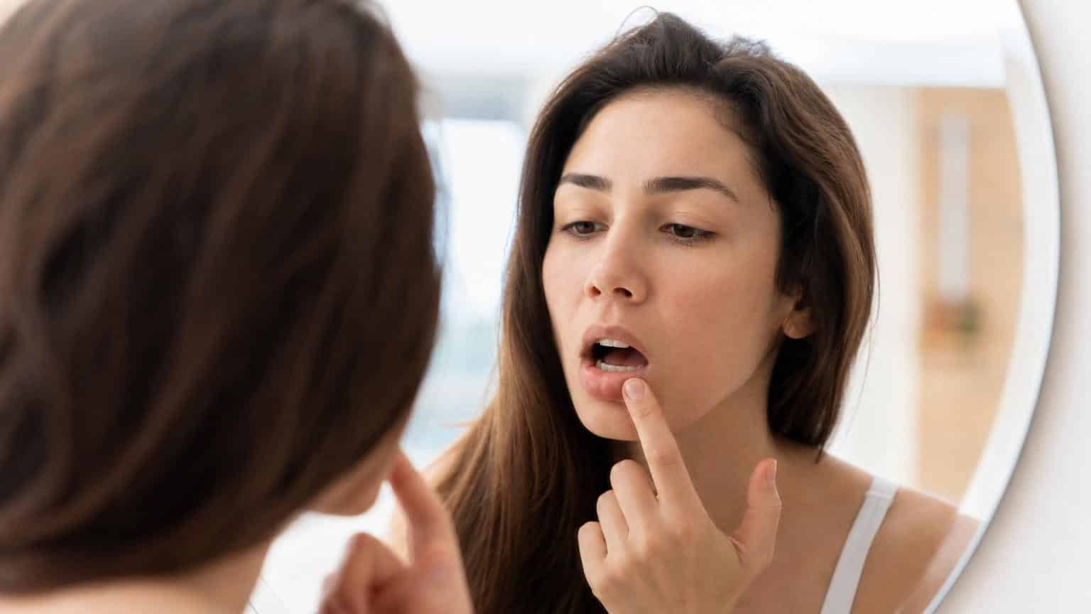 Woman looking in a bathroom mirror and pointing her finger at a painful canker sore on her lower lip.